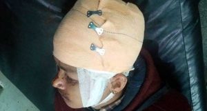 Nepali Congress cadre survives murder attempt in Butwal