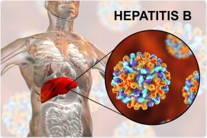 From viral threat to economic burden and serious health challenge: The global impact of hepatitis