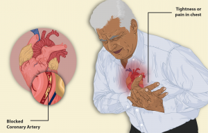 8 foods to reduce the risk of heart attack in winter